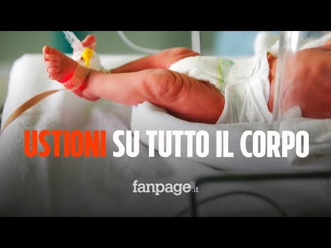 Tragedia a Portici, neonato con ustioni su tutto il corpo: arrestati i genitori