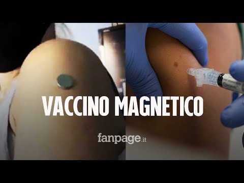 I vaccini Covid non rendono il braccio magnetico: ecco perché