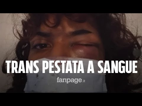 Trans aggredita in un locale a Catania: “Pestata a sangue, nessuno mi ha aiutata”