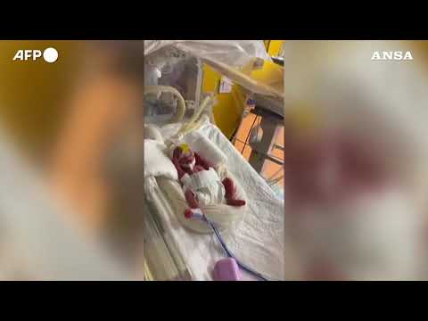 Parto record in Marocco, 25enne da’ alla luce 9 gemelli