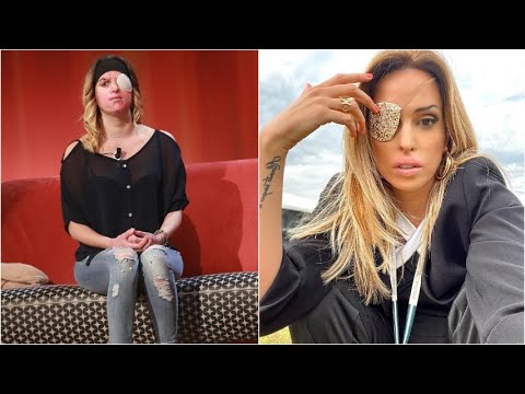 Sfregiata con l’acido, oggi si batte contro la violenza sulle donne: la storia di Gessica Notaro