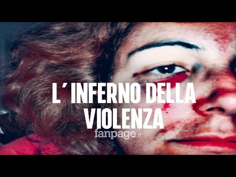 L’inferno dentro casa, la storia di Patrizia: “Quello che mi ha ferito di più? Lo sputo”
