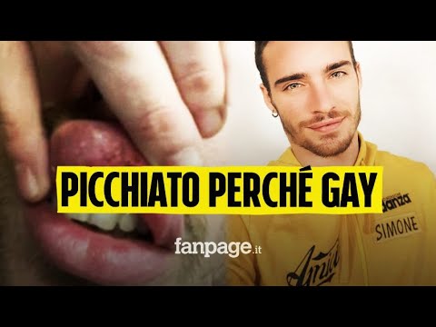 Ballerino di Amici picchiato a Roma: “Mi hanno urlato fr**io, poi i pugni in faccia”