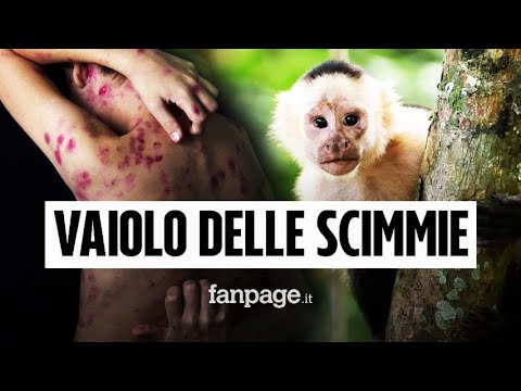 Vaiolo delle scimmie in Europa, casi confermati in Spagna e Portogallo: quali sono i sintomi