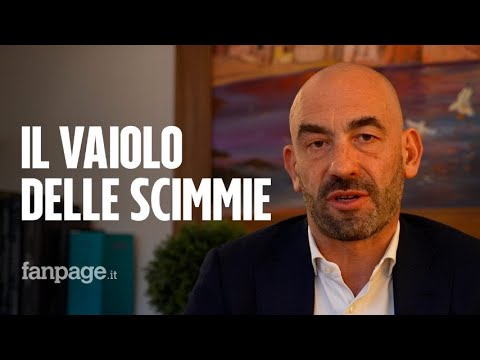 Matteo Bassetti spiega a Fanpage.it perché non ci si deve preoccupare del vaiolo delle scimmie