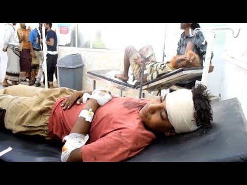 Le facce mostruose della cieca violenza