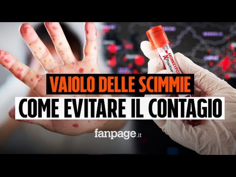 Come evitare di prendere il vaiolo delle scimmie in vacanza e a cosa bisogna stare attenti