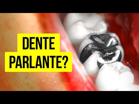 Questa Donna Captava Le Onde Radio Con I Denti!