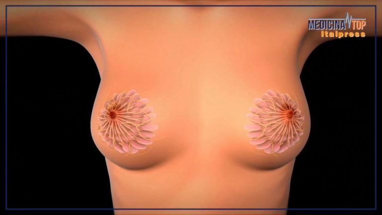 Tumore al seno, la sopravvivenza a 5 anni dalla diagnosi è dell’88%