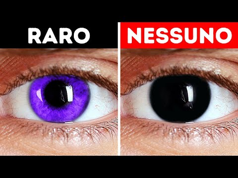 Perché gli esseri umani non hanno gli occhi viola? + Altre curiosità sul corpo!