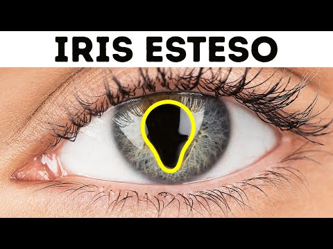 30+ Caratteristiche del corpo più rare che potreste avere o meno