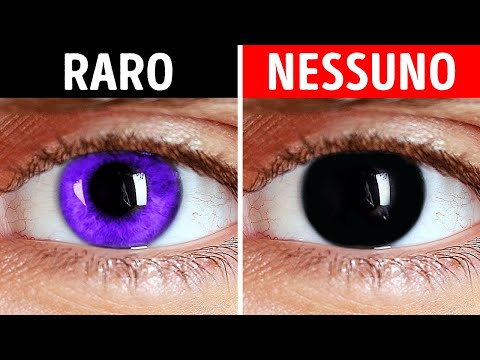 Perché non si possono avere gli occhi neri + altre curiosità sul corpo