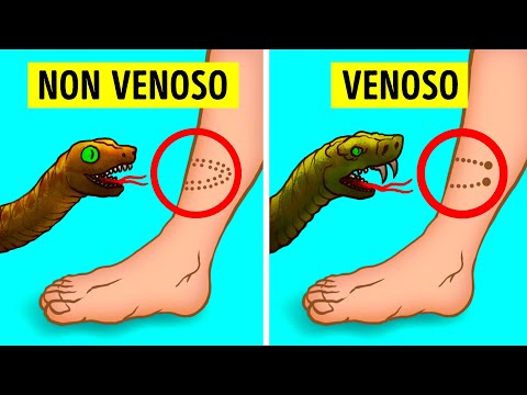 Suggerimenti inaspettati che un giorno potrebbero salvarvi la vita