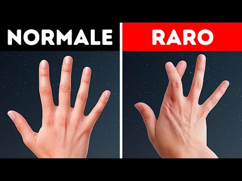 Modi strani in cui il tuo corpo è diverso dagli altri