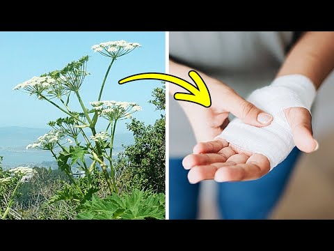 Se Vedi Questa Pianta, Evita di Toccarla a Qualsiasi Costo