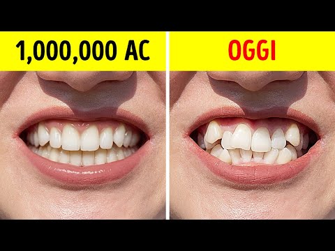 Perché gli Uomini Primitivi Avevano i Denti Perfettamente Dritti