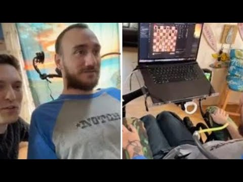 Noland, il primo paziente tetraplegico con il chip Neuralink: muove il mouse del pc con la mente