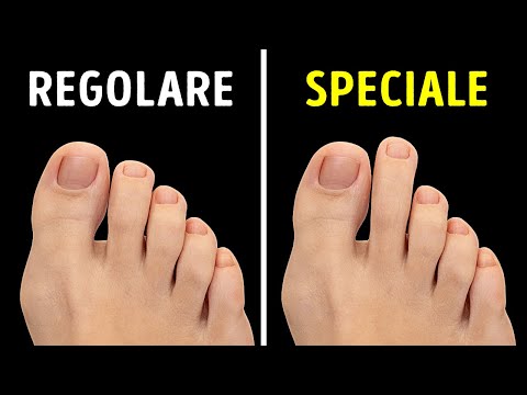 Strane Cose sul Corpo Umano che Ti Faranno Dire “Cosa?!”