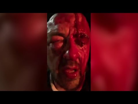 Chef Rubio, la video-denuncia dell’aggressione a Roma con il volto insanguinato: «Mi hanno mass…