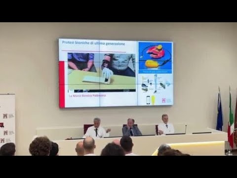 Padova, protesi bionica per arti amputati: la dimostrazione del video