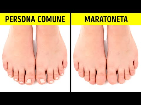 Fatti Stupefacenti sul Corpo che Ti Lasceranno a Bocca Aperta