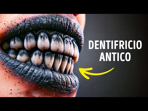 Passate Tecnologie Brillanti che Abbiamo Perso e le Tecnologie Future di cui Abbiamo Bisogno