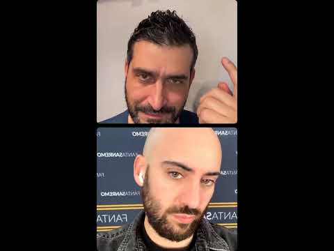 Ma tu l’hai visto #Sanremo2025? Siamo in diretta, aspettando la finale