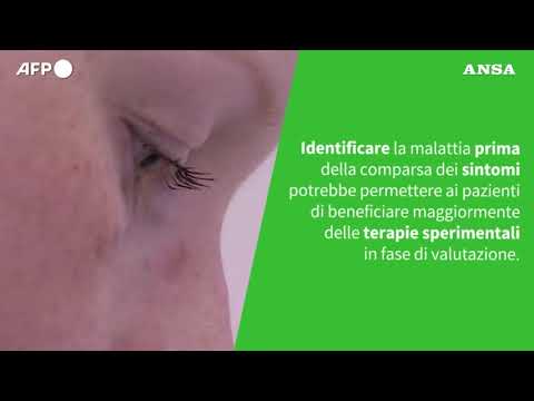 Ansa VERIFIED – E’ vero che l’Alzheimer si potra’ diagnosticare precocemente?