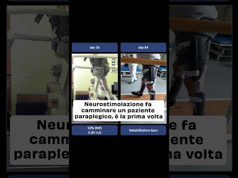 Grazie alla neurostimolazione midollare per la prima volta al mondo un paziente torna a camminare