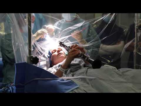 La donna operata al cervello a Londra mentre suona il clarinetto