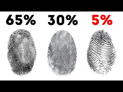 Se hai questa caratteristica fisica, sei uno su un milione