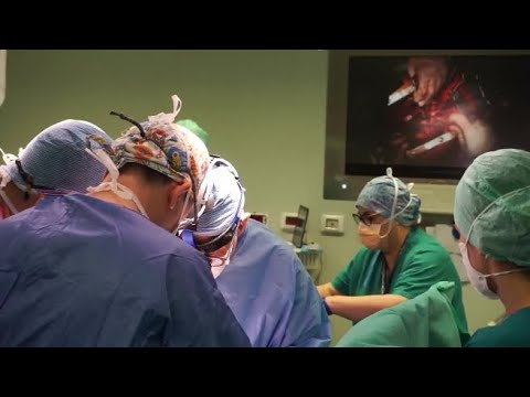 Il doppio trapianto di cuore all’ospedale Papa Giovanni XXIII di Bergamo